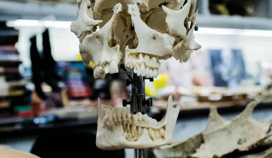 A disarticulated skull